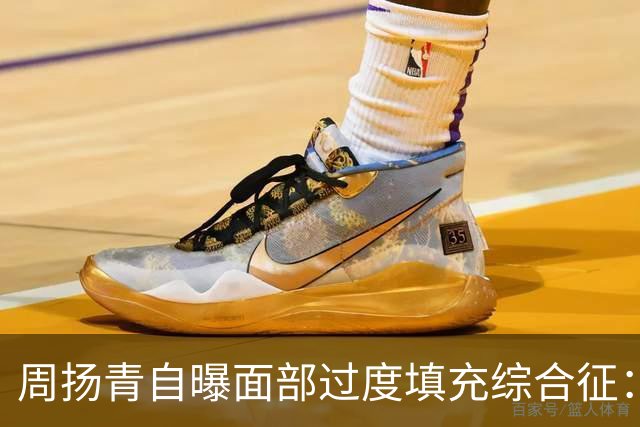 周扬青自曝面部过度填充综合征：被夸抗老时，她亲手撕开了医美滤镜